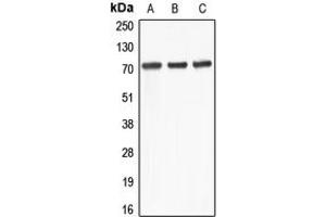 Western blot analysis of ABCD4 expression in Jurkat (A), Raji (B), THP1 (C) whole cell lysates. (ABCD4 antibody  (Center))
