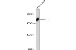 Western blot analysis of extracts of mouse testis, using F antibody (ABIN7267126) at 1:1000 dilution. (FANCD2 antibody)