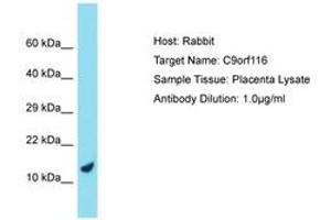 Image no. 1 for anti-Chromosome 9 Open Reading Frame 116 (C9ORF116) (AA 39-88) antibody (ABIN6750756) (C9ORF116 antibody  (AA 39-88))