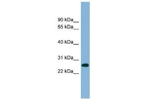 SRRP35 antibody used at 1 ug/ml to detect target protein. (SRSF12 antibody  (Middle Region))