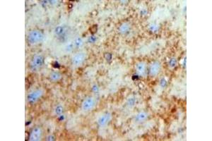 IHC-P analysis of Brain tissue, with DAB staining. (Neurotrypsin antibody  (AA 153-399))