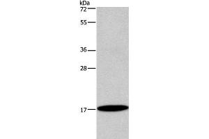 Western Blot analysis of Mouse bladder tissue using ID4 Polyclonal Antibody at dilution of 1:300