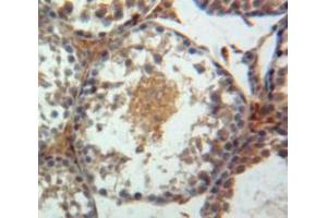IHC-P analysis of Testis tissue, with DAB staining. (Paxillin antibody  (AA 347-578))
