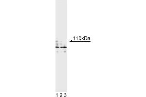 Western Blotting (WB) image for anti-Androgen Receptor (AR) antibody (ABIN967444) (Androgen Receptor antibody)