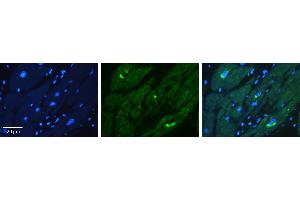 Rabbit Anti-KAT5 Antibody Catalog Number: ARP38792_P050 Formalin Fixed Paraffin Embedded Tissue: Human heart Tissue Observed Staining: Cytoplasmic Primary Antibody Concentration: 1:100 Other Working Concentrations: 1:600 Secondary Antibody: Donkey anti-Rabbit-Cy3 Secondary Antibody Concentration: 1:200 Magnification: 20X Exposure Time: 0. (KAT5 antibody  (C-Term))