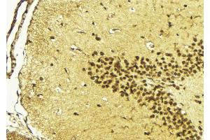 ABIN6268716 at 1/100 staining Mouse brain tissue by IHC-P.