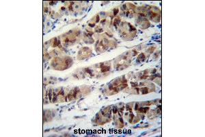 PCIA1 Antibody (Center) (ABIN658015 and ABIN2846953) immunohistochemistry analysis in formalin fixed and paraffin embedded human stomach tissue followed by peroxidase conjugation of the secondary antibody and DAB staining. (DDA1 antibody  (AA 11-40))