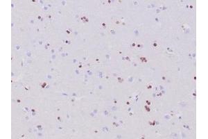 Immunohistochemistry (IHC) image for anti-Oligodendrocyte Lineage Transcription Factor 2 (OLIG2) (AA 200-300) antibody (ABIN7504157)