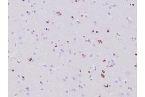 Formalin-fixed, paraffin-embedded human cerebrum stained with OLIG2 Recombinant Rabbit Monoclonal Antibody (OLIG2/6695R).