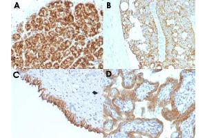 Immunohistochemical staining (Formalin-fixed paraffin-embedded sections) of human pancreas (A), human colon carcinoma (B), human bladder carcinoma (C) and human placenta (D) with MAML2 monoclonal antibody, clone MAML2/1302 . (MAML2 antibody)