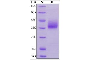SDS-PAGE (SDS) image for SLAM Family Member 6 (SLAMF6) (AA 22-226) (Active) protein (His tag) (ABIN6253581)