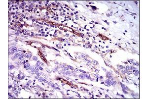 Immunohistochemistry (IHC) image for anti-CD59 (CD59) (AA 31-111) antibody (ABIN1845905)