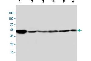 Western blot analysis of tissue and whole cell extracts with HTR2A polyclonal antibody . (HTR2A antibody  (C-Term))