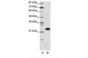 Image no. 1 for anti-TATA Box Binding Protein Associated Factor 11 (TAF11) (N-Term) antibody (ABIN6736151) (TAF11 antibody  (N-Term))