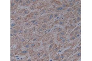 IHC-P analysis of liver tissue, with DAB staining. (ACADL antibody  (Lys430))