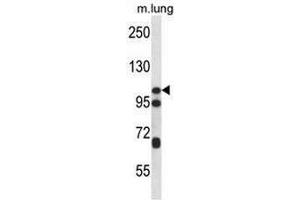 CTNND2 Antibody (C-term) western blot analysis in mouse lung tissue lysates (35µg/lane).