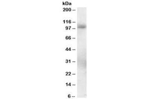 Western blot testing of human lung lysate with PDE5 antibody at 0. (PDE5A antibody)