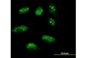 Image no. 1 for anti-LIM Homeobox 1 (LHX1) (AA 1-101) antibody (ABIN598782) (LHX1 antibody  (AA 1-101))