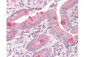 Anti-VAMP7 / SYBL1 / T1 VAMP antibody IHC staining of human small intestine. (VAMP7 antibody  (N-Term))