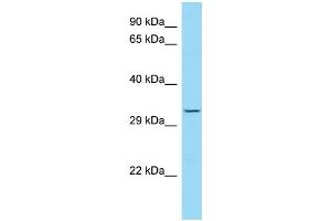 Western Blotting (WB) image for anti-Trophinin (TRO) (C-Term) antibody (ABIN2789476) (TRO antibody  (C-Term))