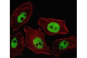 Fluorescent image of U251 cell stained with PHOX2B antibody. (PHOX2B antibody  (AA 104-130))