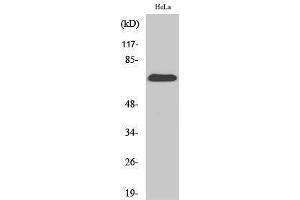 Western Blotting (WB) image for anti-Succinate Dehydrogenase Complex, Subunit A, Flavoprotein (Fp) (SDHA) (C-Term) antibody (ABIN3186888)