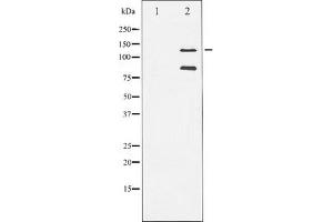 Western blot analysis of extracts from A549 cells,The lane on the left is treated with the antigen-specific peptide. (PARP1 antibody  (Cleaved-Ala214))