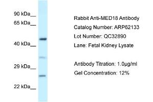 Western Blotting (WB) image for anti-Mediator Complex Subunit 18 (MED18) (Middle Region) antibody (ABIN2789031) (MED18 antibody  (Middle Region))