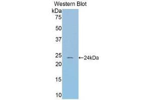 Western Blotting (WB) image for anti-serpin Peptidase Inhibitor, Clade A (Alpha-1 Antiproteinase, Antitrypsin), Member 6 (SERPINA6) (AA 57-256) antibody (ABIN1858267)
