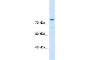 WB Suggested Anti-ACTN4  Antibody Titration: 0. (alpha Actinin 4 antibody  (C-Term))
