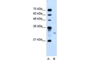 Western Blotting (WB) image for anti-1-Acylglycerol-3-Phosphate O-Acyltransferase 2 (Lysophosphatidic Acid Acyltransferase, Beta) (AGPAT2) antibody (ABIN2463969) (AGPAT2 antibody)