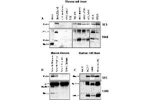 Western Blotting (WB) image for anti-BCL2-Like 11 (Apoptosis Facilitator) (BCL2L11) antibody (ABIN187549) (BIM antibody)