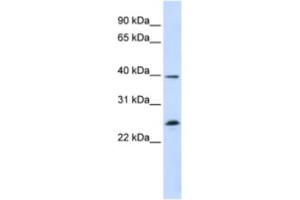 Western Blotting (WB) image for anti-Single-Stranded DNA Binding Protein 2 (SSBP2) antibody (ABIN2460285)