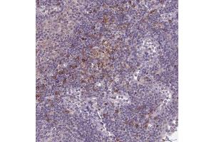 Immunohistochemical staining (Formalin-fixed paraffin-embedded sections) of human lymph node with CD1E polyclonal antibody  shows moderate cytoplasmic positivity in subset of non-germinal center cells. (CD1e antibody  (AA 79-147))