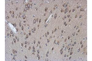 Image no. 1 for anti-Poly(A) Binding Protein, Cytoplasmic 4 (Inducible Form) (PABPC4) (AA 18-229) antibody (ABIN1500006) (PABPC4 antibody  (AA 18-229))