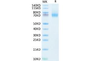 Human IL-7R alpha on Tris-Bis PAGE under reduced condition. (IL7R Protein (Fc Tag))
