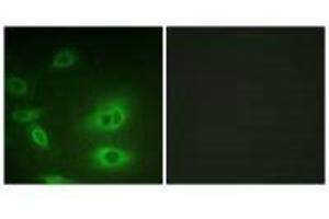 Immunofluorescence analysis of HeLa cells, using ATP1α1/Na+K+ ATPase1 (Ab-23) antibody. (ATP1A1 antibody  (Ser23))