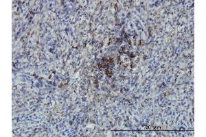Immunostaining (ISt) image for anti-SWAP Switching B-Cell Complex 70kDa Subunit (SWAP70) (AA 378-451) antibody (ABIN565005)