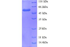 SDS-PAGE (SDS) image for Zinc Finger and SCAN Domain Containing 21 (Zscan21) (AA 1-461), (partial) protein (His tag) (ABIN5712874)