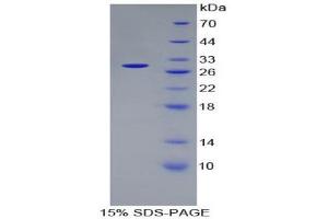 SDS-PAGE (SDS) image for DNA Repair Protein Complementing XP-G Cells (ERCC5) (AA 778-986) protein (His tag) (ABIN1879686) (ERCC5 Protein (AA 778-986) (His tag))