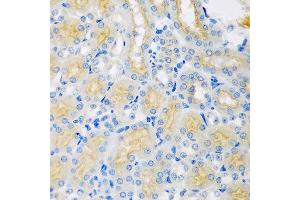 Immunohistochemistry of paraffin-embedded mouse kidney using CYP4A11 antibody at dilution of 1:100 (40x lens).