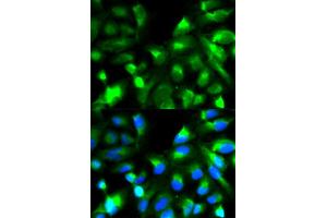 Immunofluorescence analysis of HeLa cell using SNAP25 antibody. (SNAP25 antibody)