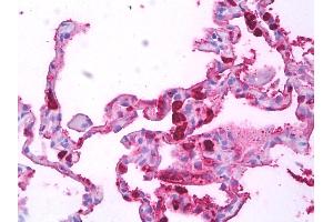 Anti-Macrophages antibody IHC of human lung, macrophages. (Macrophages antibody)
