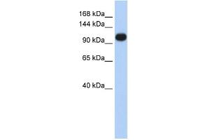 WB Suggested Anti-ATP2A3 Antibody Titration:  0. (ATP2A3 antibody  (Middle Region))
