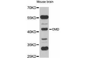 Western blot analysis of extracts of mouse brain, using OMD antibody (ABIN6290709) at 1:1000 dilution.