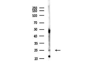 anti-Emopamil Binding Protein (Sterol Isomerase) (EBP) antibody