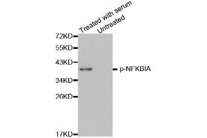 Western blot analysis of extracts of HeLa cell lines, using Phospho-NFKBIA-Y42 antibody (ABIN2988220). (NFKBIA antibody  (pTyr42))