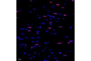 Immunofluorescent analysis of paraffin embedded mouse heart using ubp43 (ABIN7076108) at dilution of 1: 1000 (USP18 antibody)