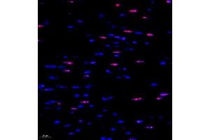 Immunofluorescent analysis of paraffin embedded mouse heart using ubp43 (ABIN7076108) at dilution of 1: 1000 (USP18 antibody)