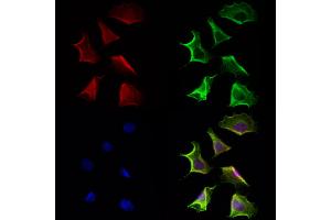 ABIN6264546 and ABIN6272948 staining Hela cells by IF/ICC. (QSOX1 antibody  (Internal Region))
